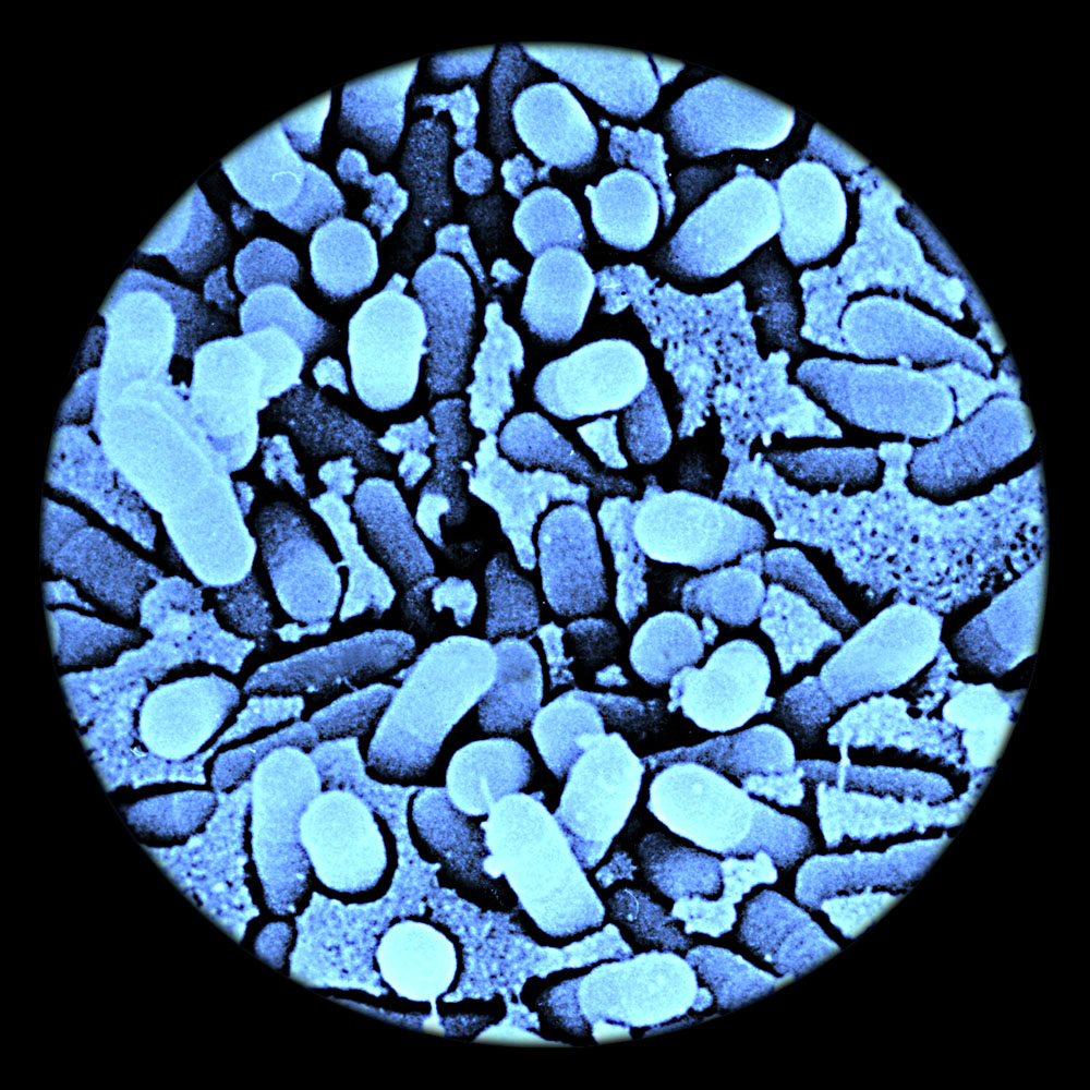 close-up of Genesis bacteria